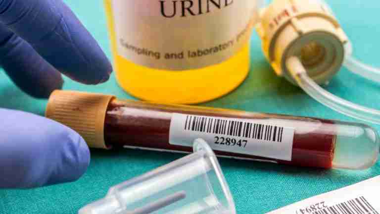 ematuria macroscopica